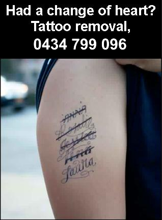 Tattoo Removal